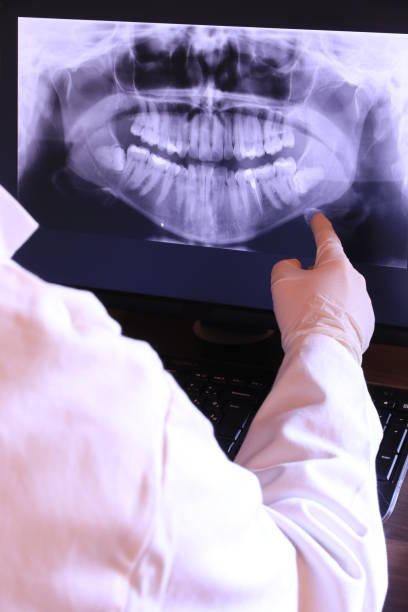 Best Emergency Treatment for Dental Infections or Abscesses in Catlettsburg, KY