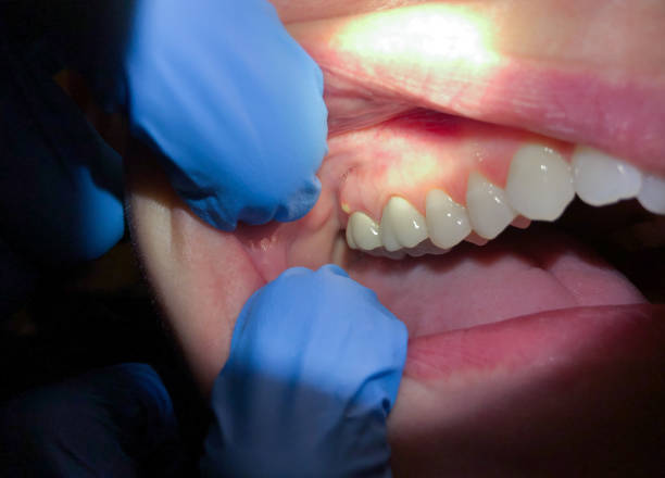 Best Cosmetic Emergency Dentistry in Catlettsburg, KY